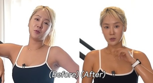 I can’t believe my face is so swollen before and after Soyou’s